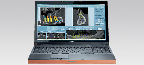 Diagnose- & Planungssoftware CTV
