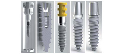 Zweiteilige Champions (R)Evolutions - Implantate