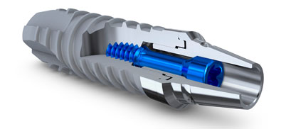 ELEMENT Implantat & EASY Abutment