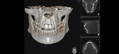 Duo3D12