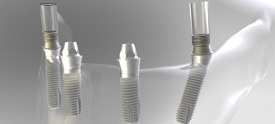 MultiPlus-System