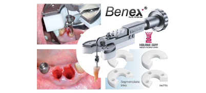 Benex-System