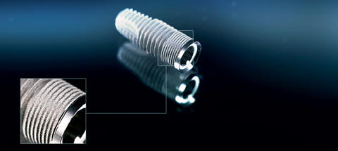 SL-Implantat