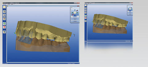 CEREC Connect