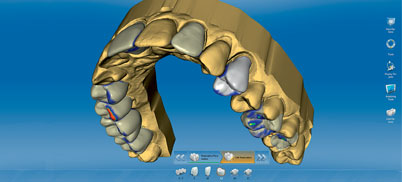 inLab Software 4.0