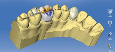 Software für CAD/CAM-System CEREC