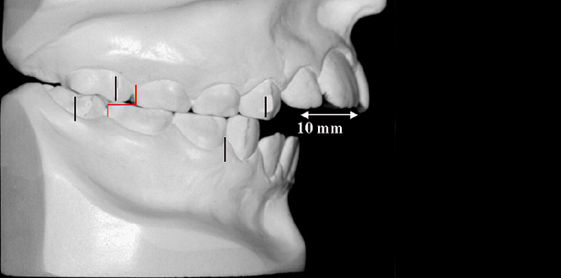 Korrekte Diagnose als Voraussetzung für dentofaziale Ästhetik und Stabilität