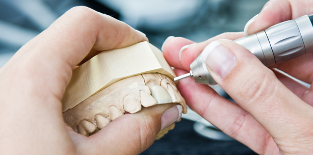 BGH: Vertragliche Verpflichtung zur Bindung an ein Dentallabor verstößt gegen Be