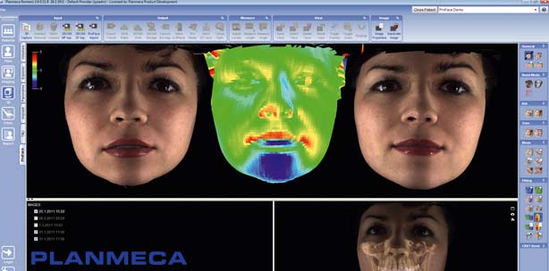 Planmeca ProMax 3D Röntgen gewinnt Produkt Design Award