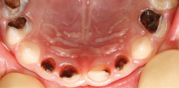 Kinderprophylaxe von Anfang an 