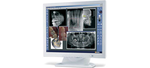 Sirona SIDEXIS XG