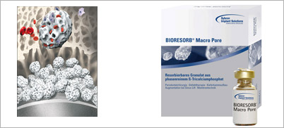 BIORESORB Macro Pore