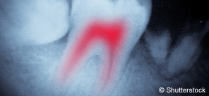 Endodontologie