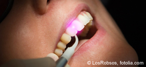Laserzahnmedizin