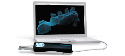Zfx IntraScan 