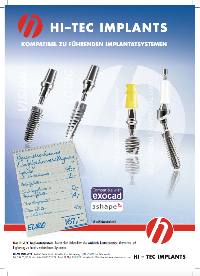 HiTec Implants ZWP online das Nachrichtenportal für die Dentalbranche
