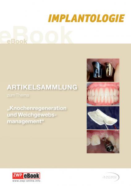 eBook Knochenregeneration