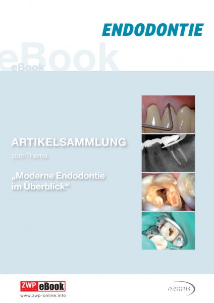 eBook Moderne Endodontie im Überblick