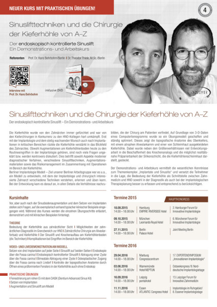 Sinuslifttechniken und die Chirurgie der Kieferhöhle von A–Z