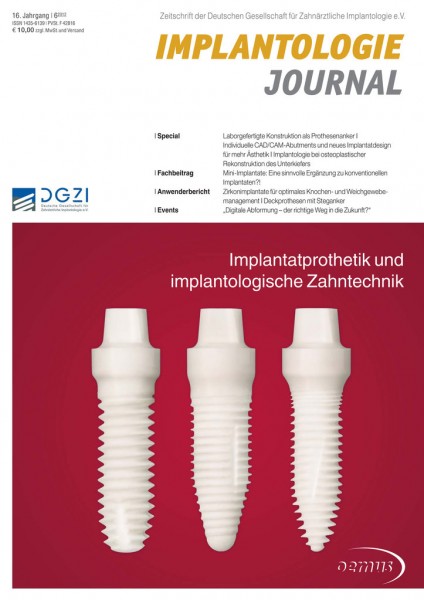 Zirkonimplantate für optimales -Knochen- und Weichgewebemanagement