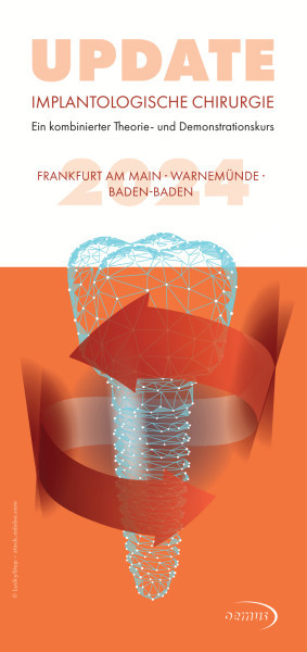 Update Implantologische Chirurgie