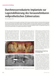 issueImage