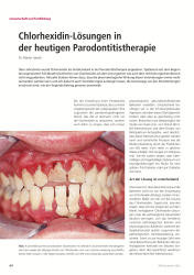 issueImage