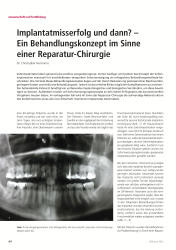 issueImage