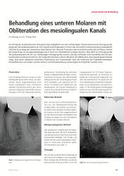 issueImage