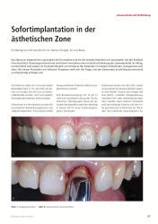 issueImage