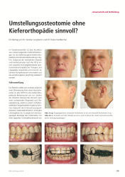 issueImage