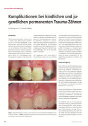 issueImage