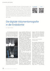 issueImage
