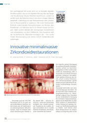 issueImage