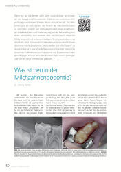 issueImage
