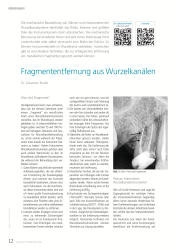 issueImage