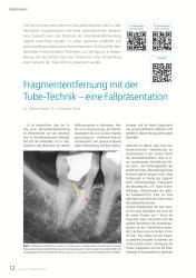 issueImage