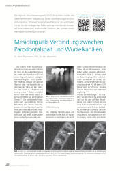 issueImage