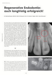 issueImage