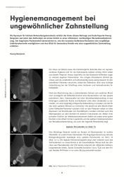 issueImage