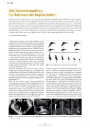 issueImage