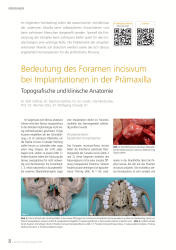 issueImage