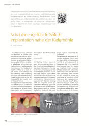 issueImage