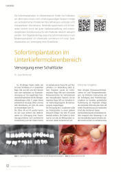 issueImage