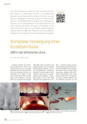 issueImage