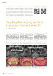 issueImage