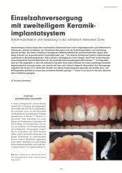 issueImage