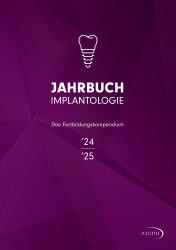 Implantologie Handbuch 24/2024