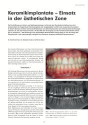 issueImage