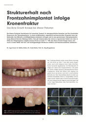 issueImage